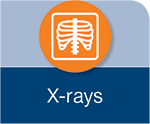 X-rays - CRC